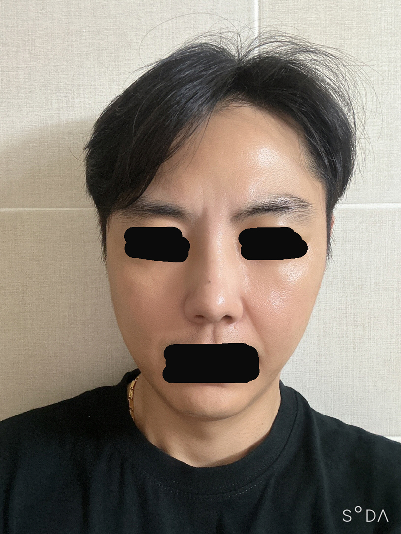 수술후기이미지