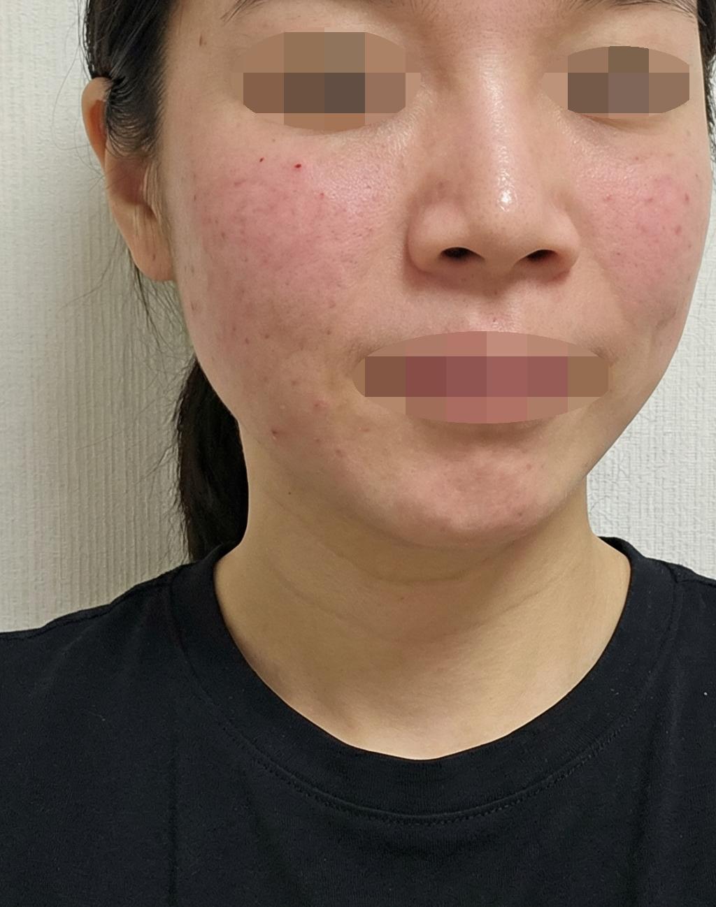 수술후기이미지