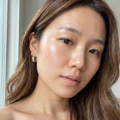 수술후기이미지