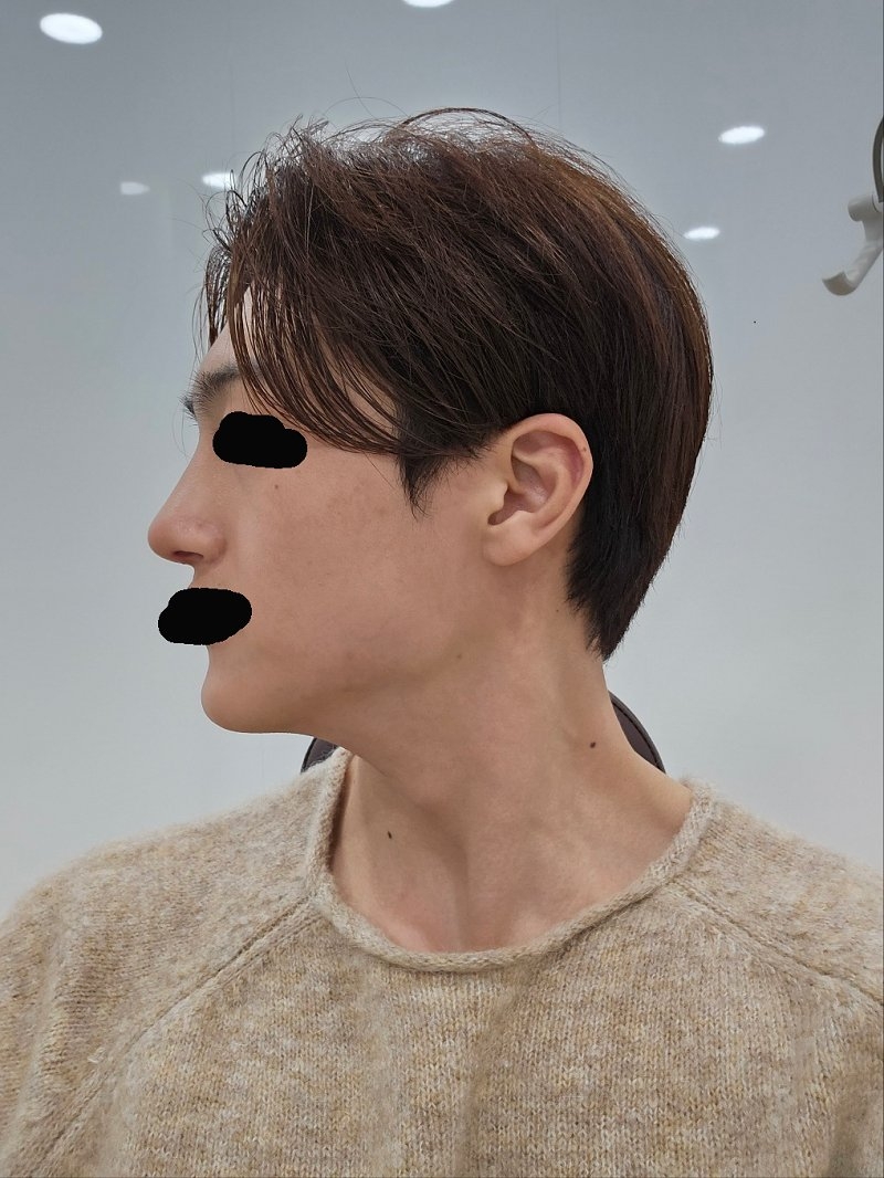 수술후기이미지