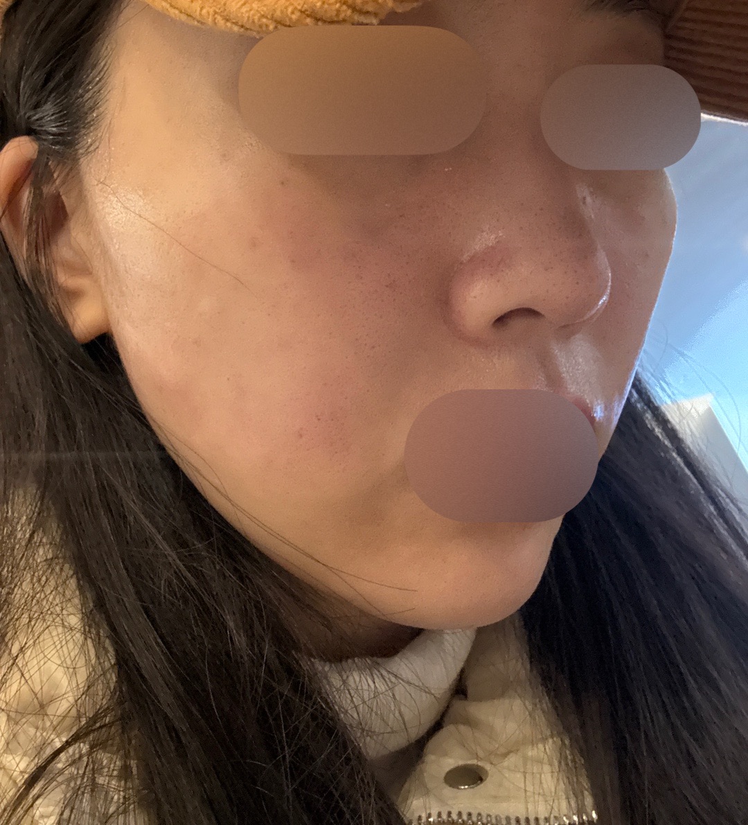 수술후기이미지