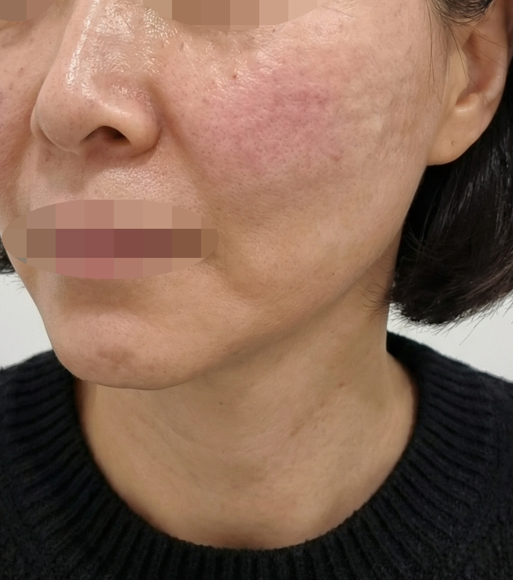 수술후기이미지