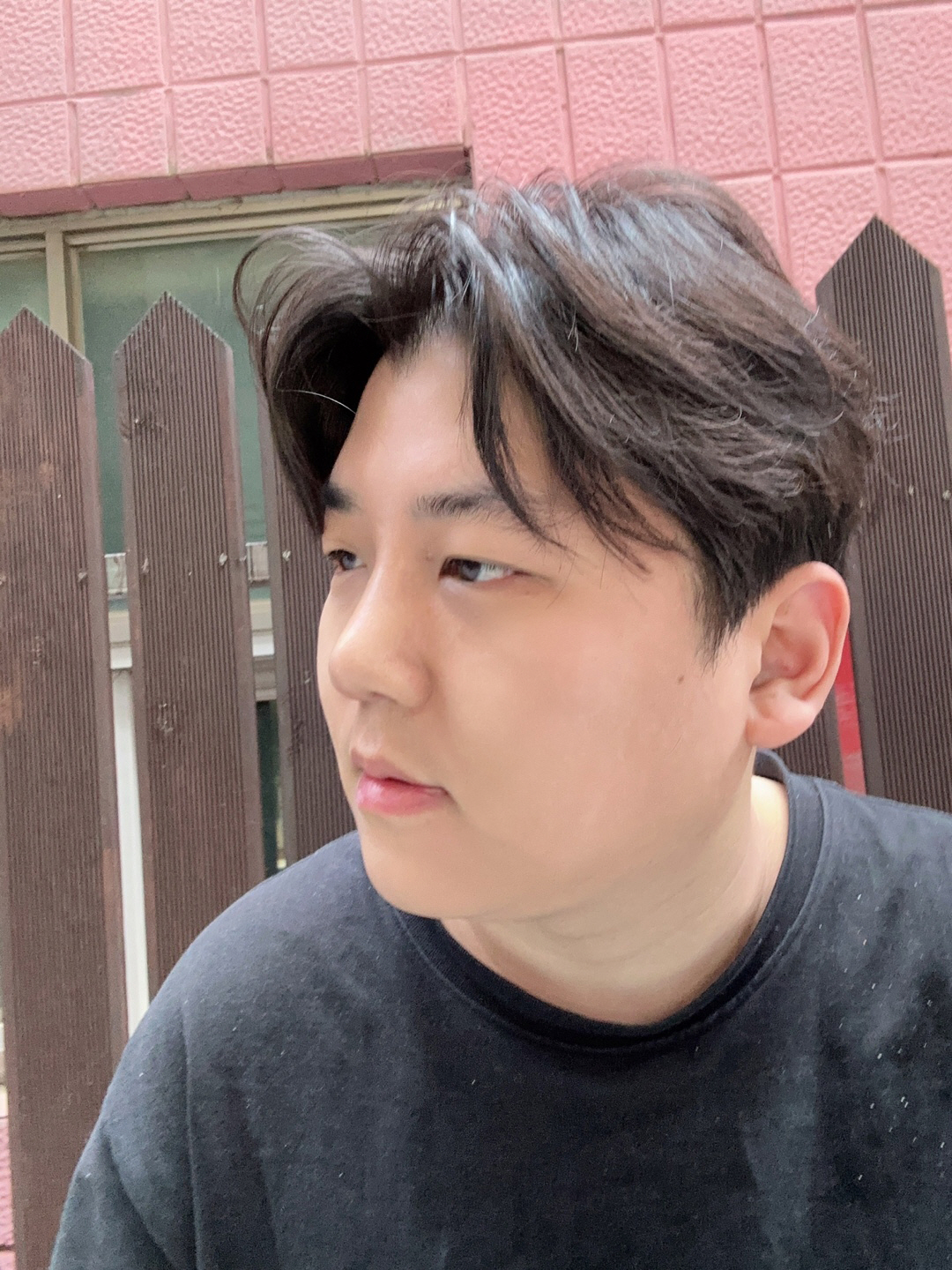 수술후기이미지