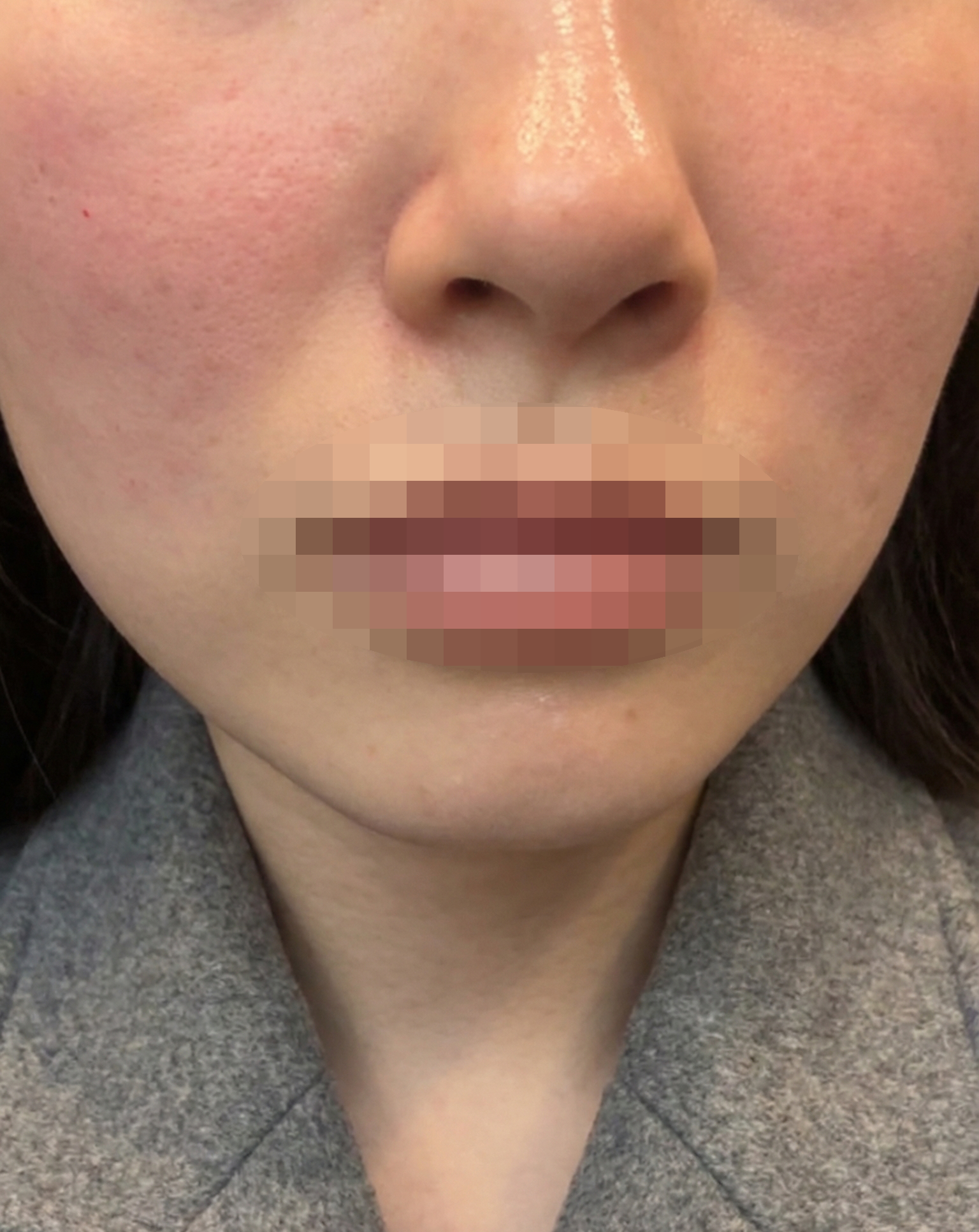 수술후기이미지