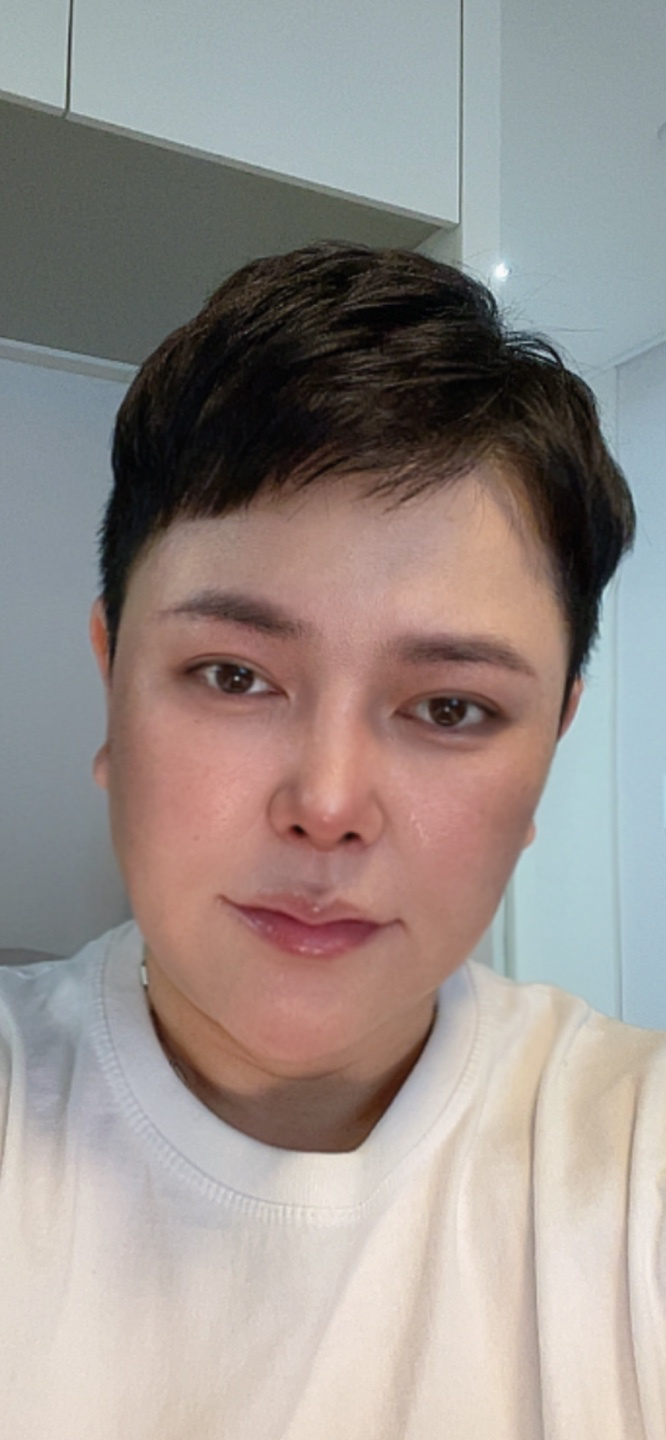 수술후기이미지