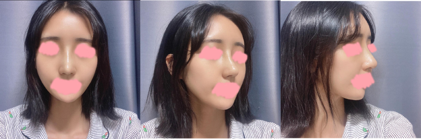 수술후기이미지