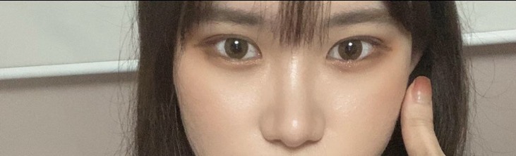 콧볼축소, 코끝, 쌍꺼풀