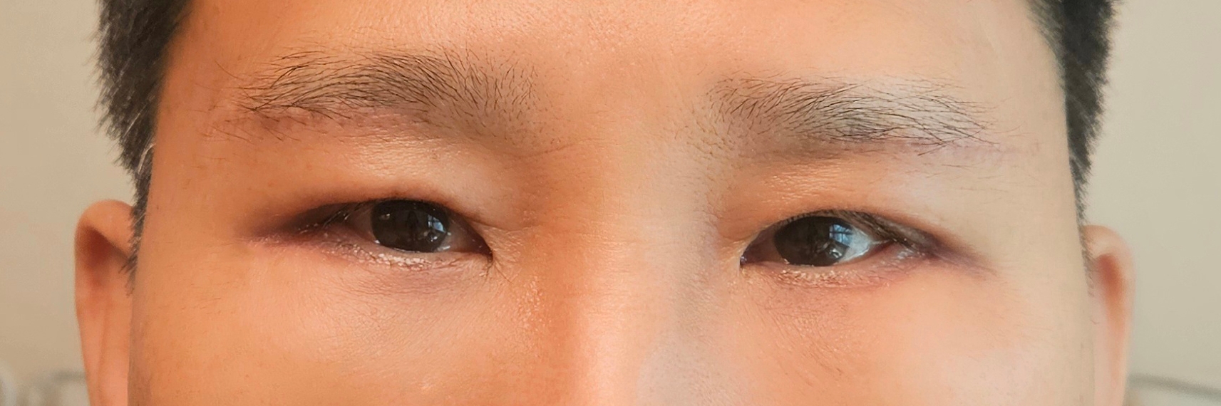 수술후기이미지
