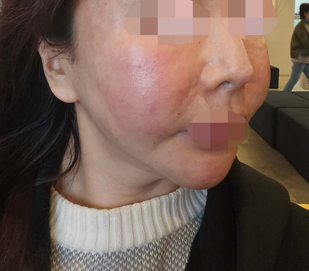 수술후기이미지