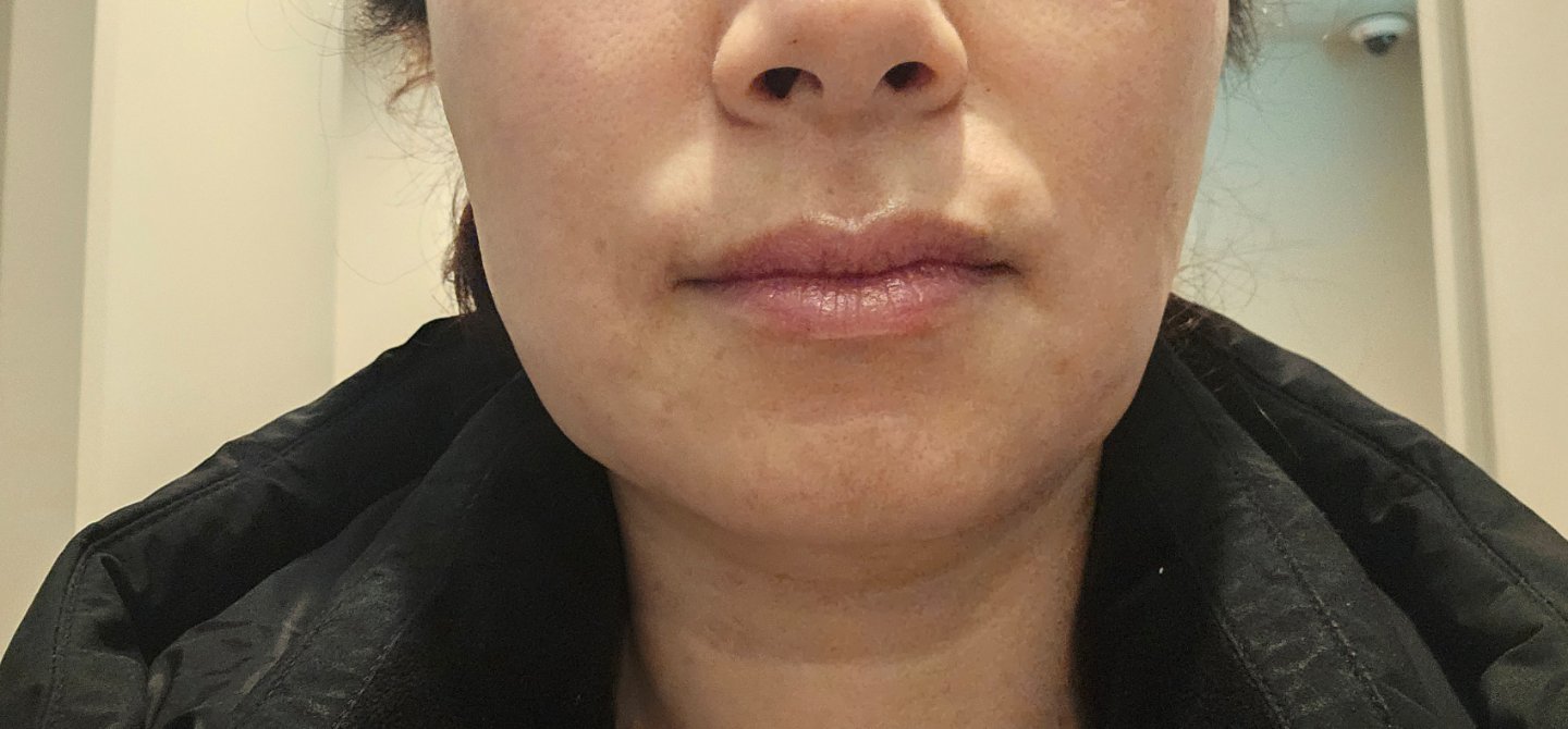 수술후기이미지