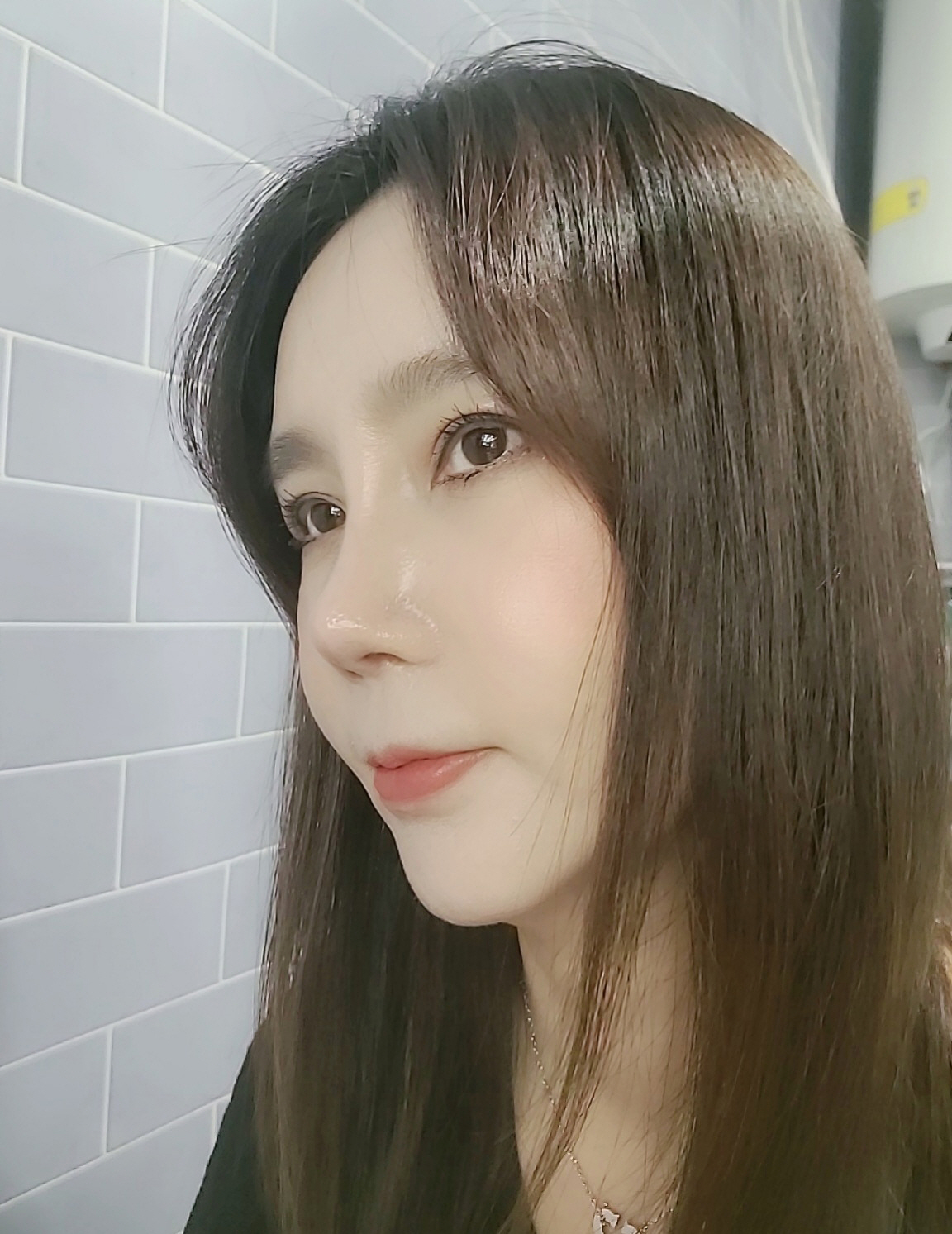 수술후기이미지