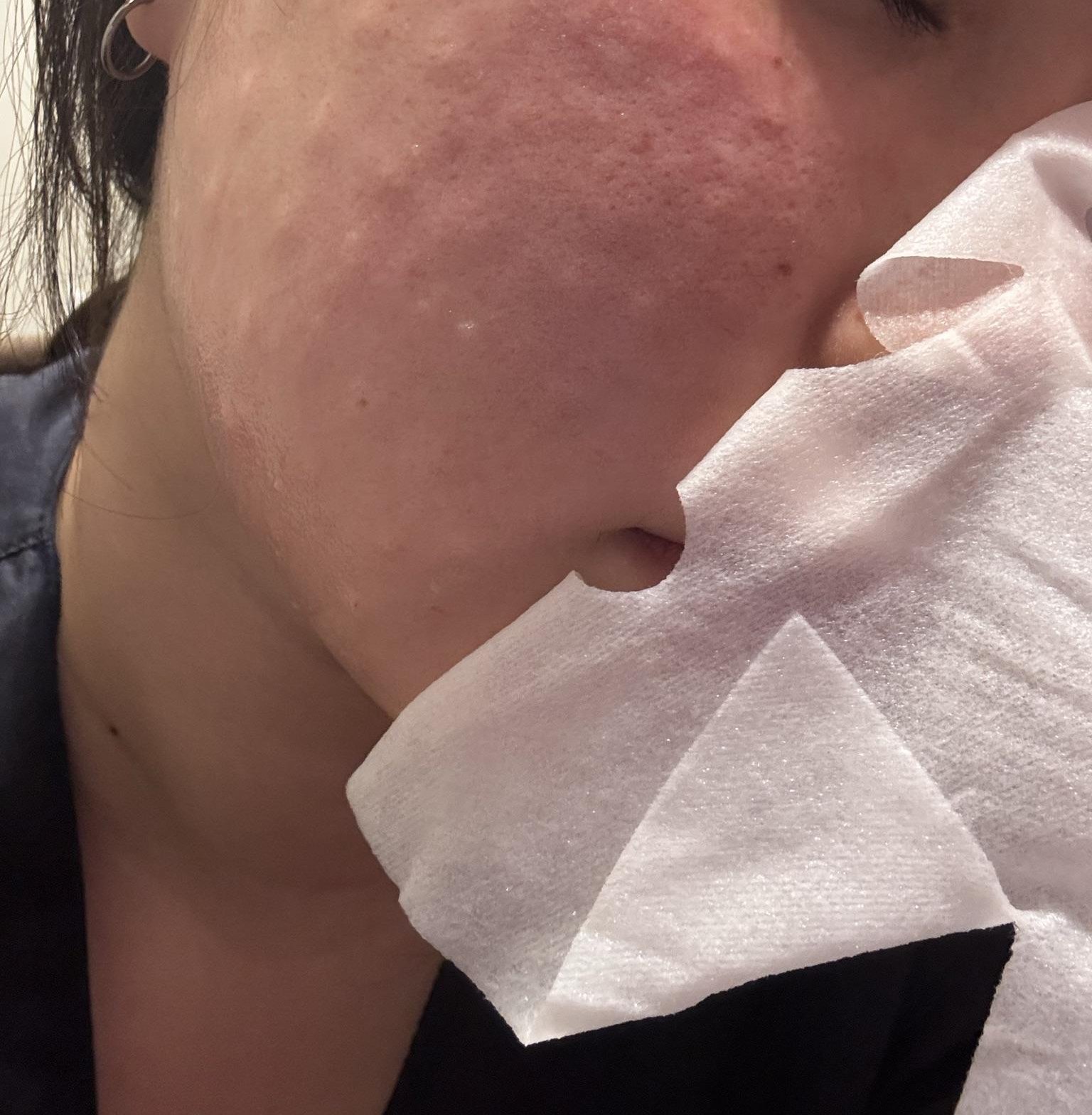 수술후기이미지