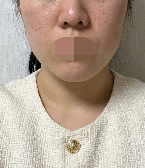 수술후기이미지