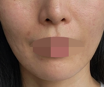 수술후기이미지