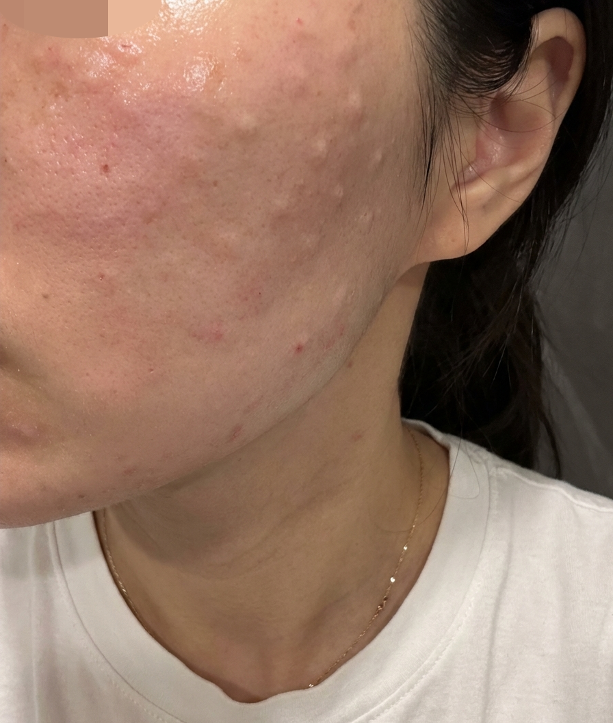 수술후기이미지