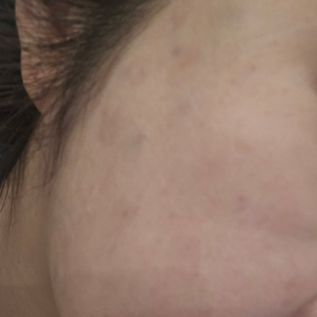 수술후기이미지