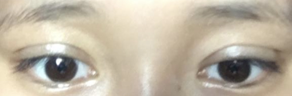 수술후기이미지