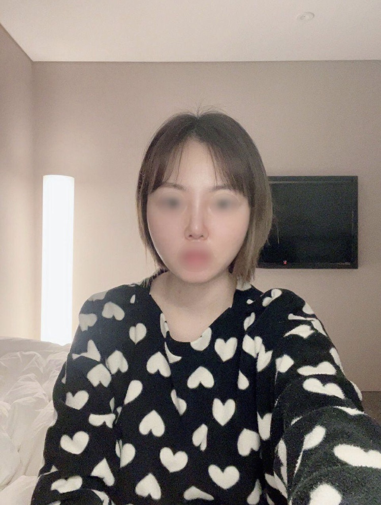 수술후기이미지