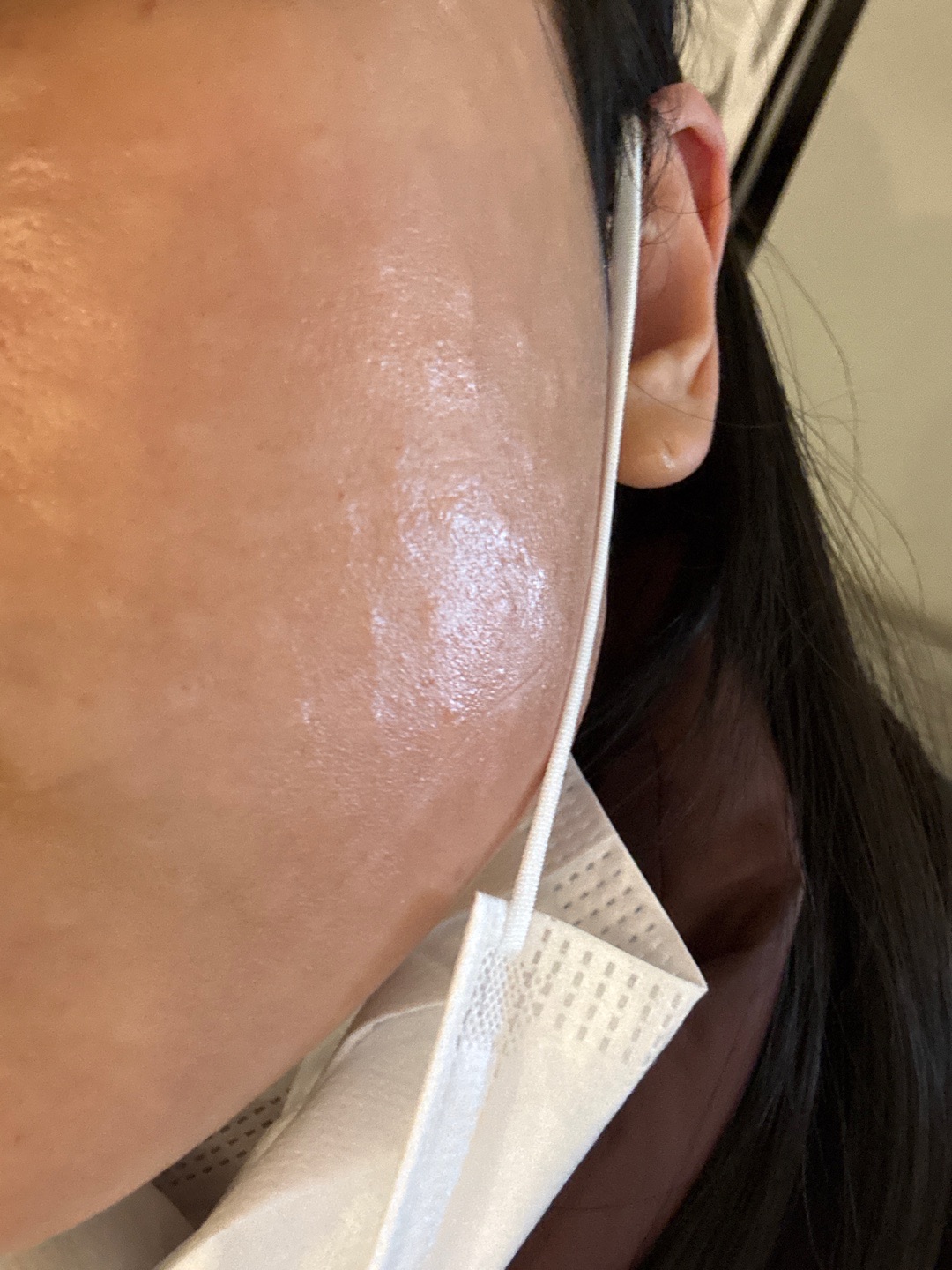 수술후기이미지