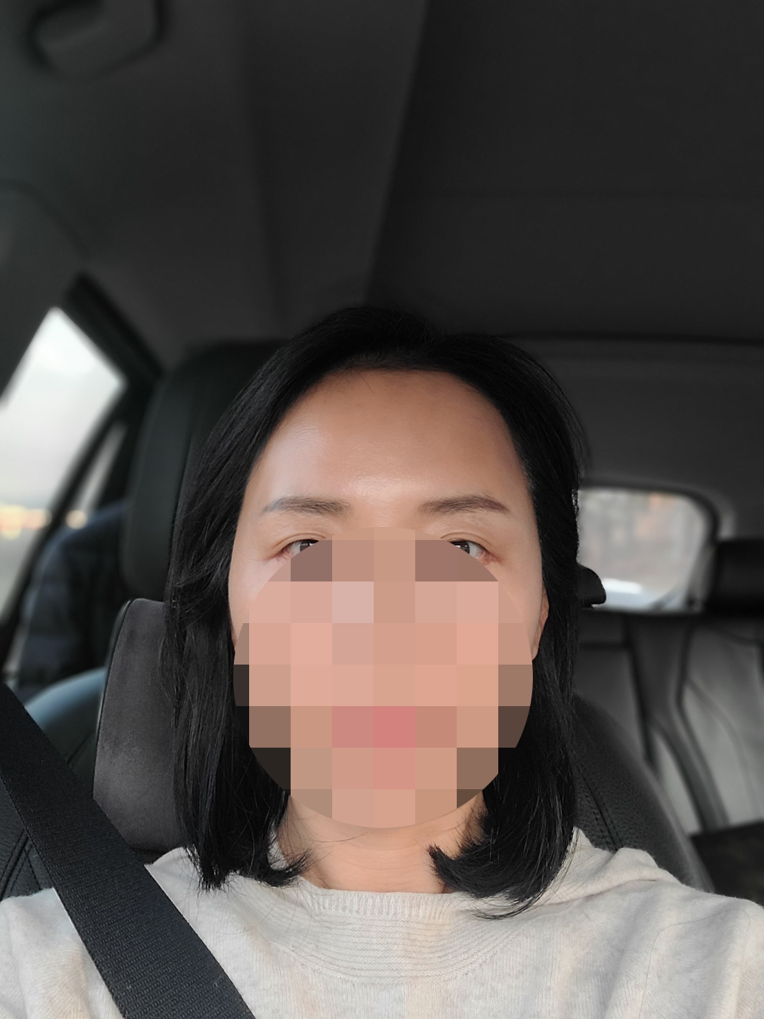 수술후기이미지