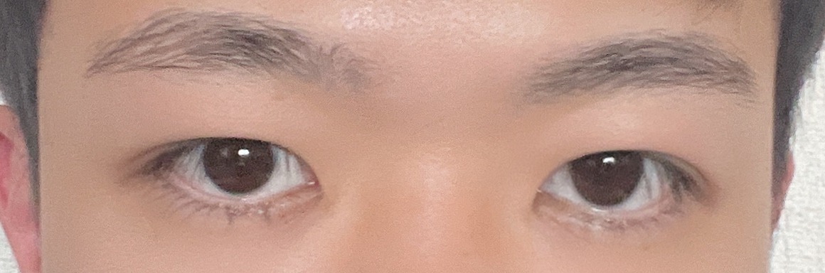 수술후기이미지