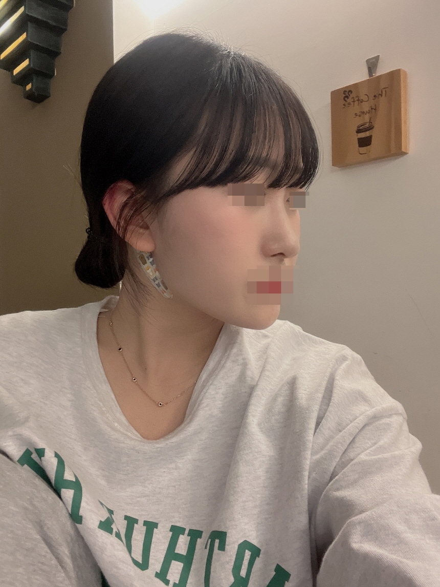 수술후기이미지