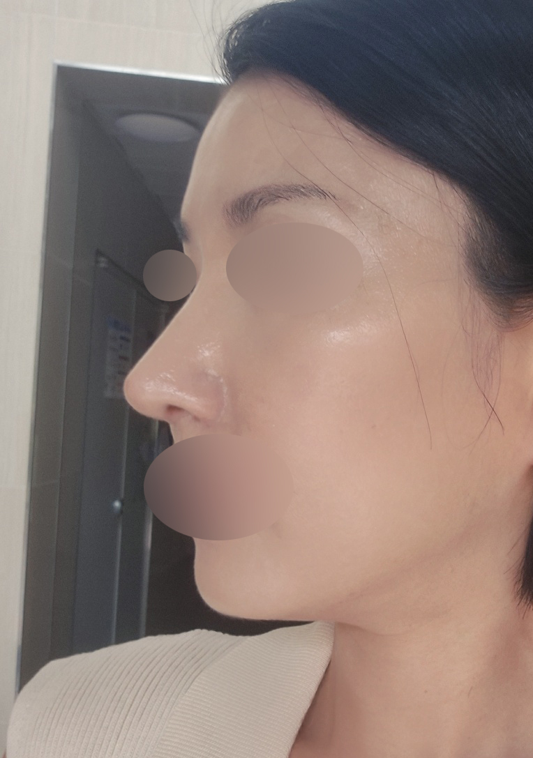 수술후기이미지