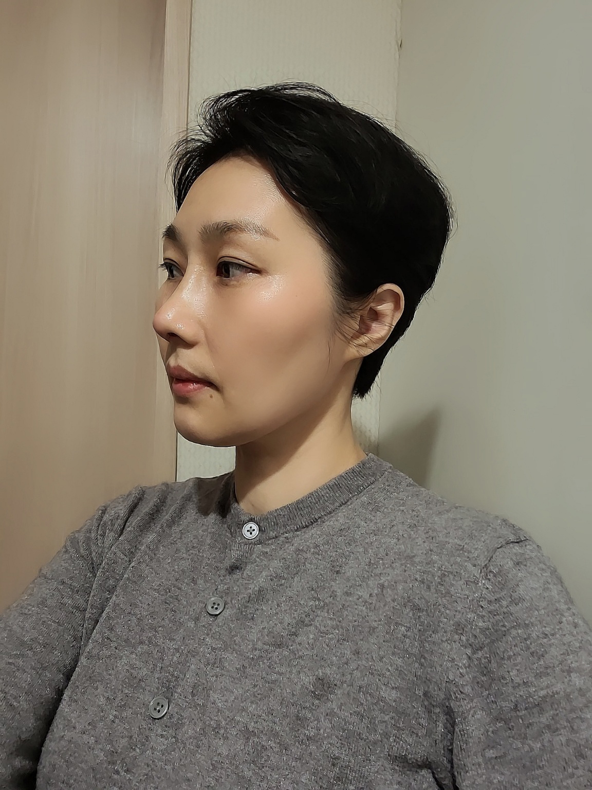 수술후기이미지