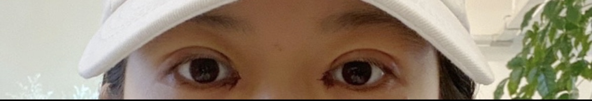 수술후기이미지