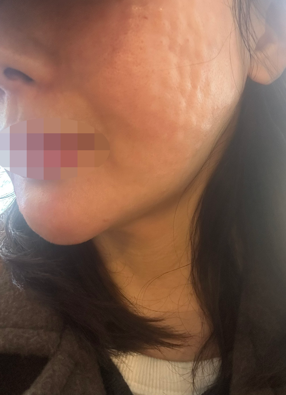 수술후기이미지