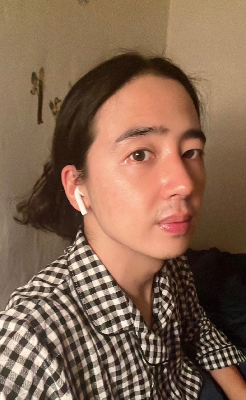 수술후기이미지