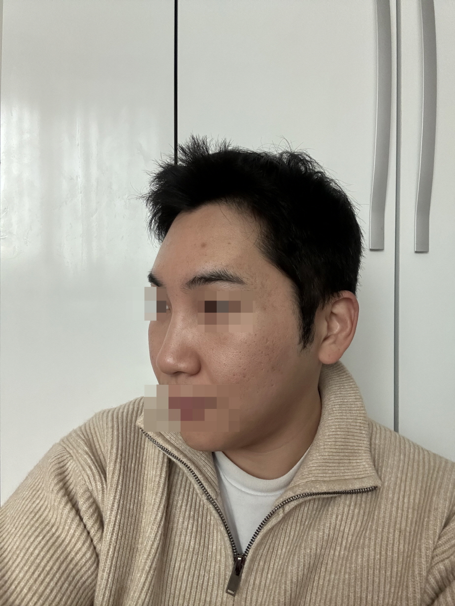 수술후기이미지