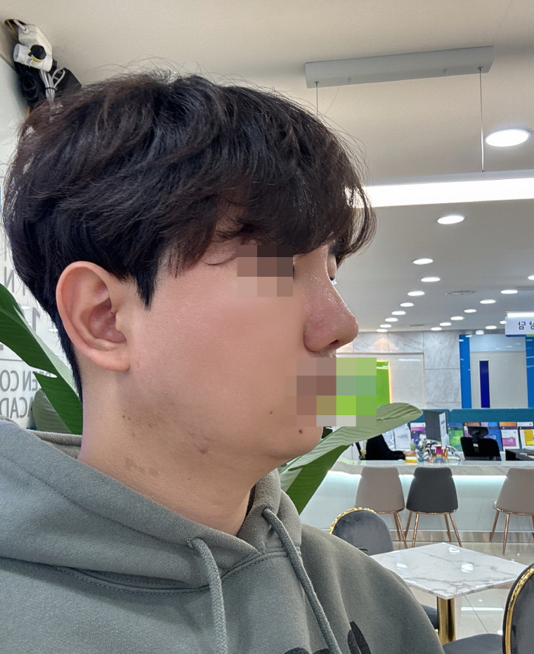 수술후기이미지