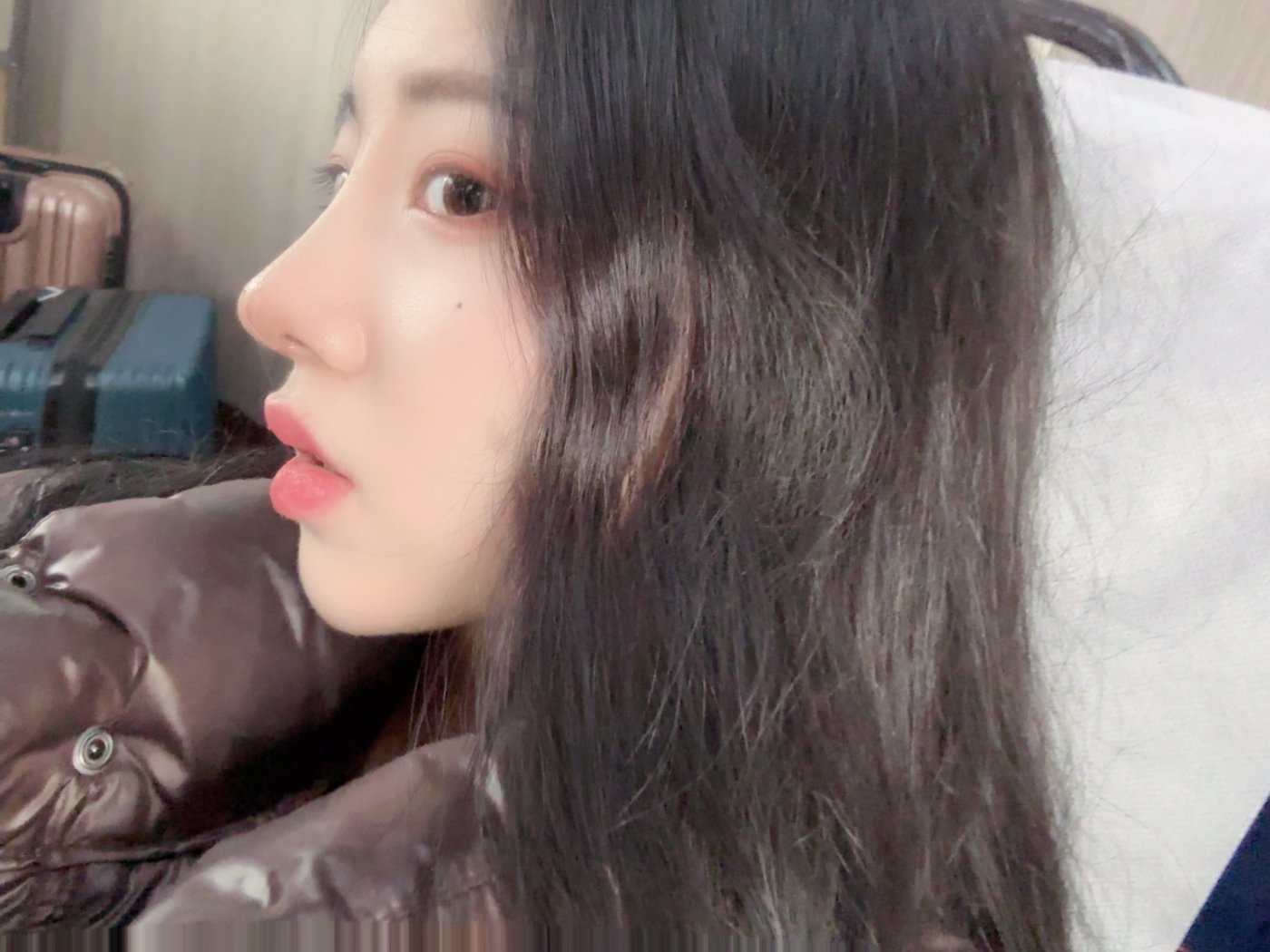 수술후기이미지