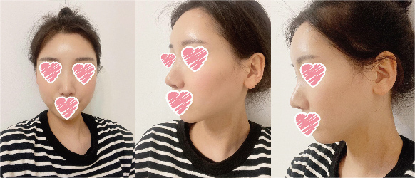 수술후기이미지