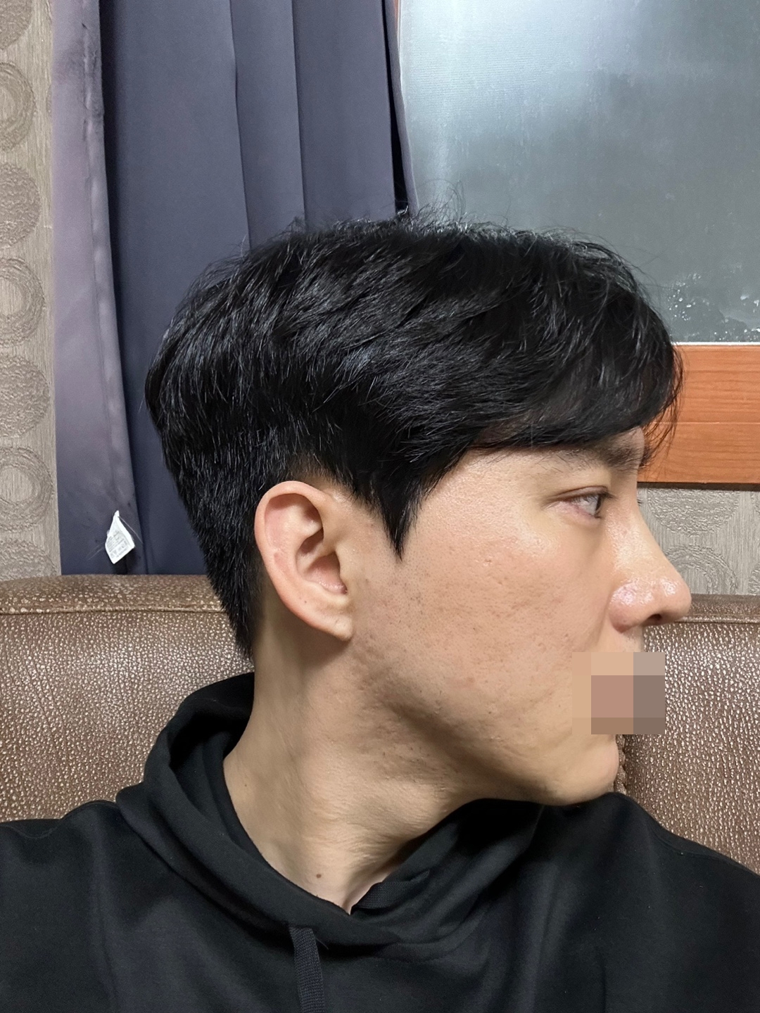 수술후기이미지