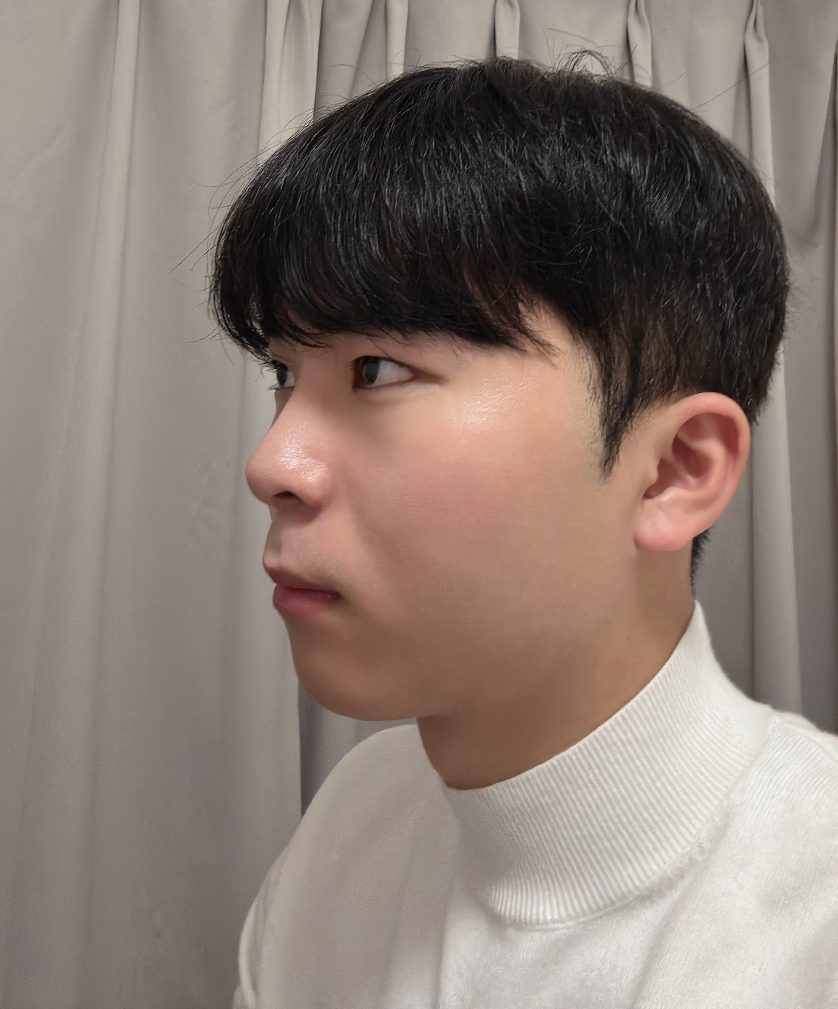 수술후기이미지