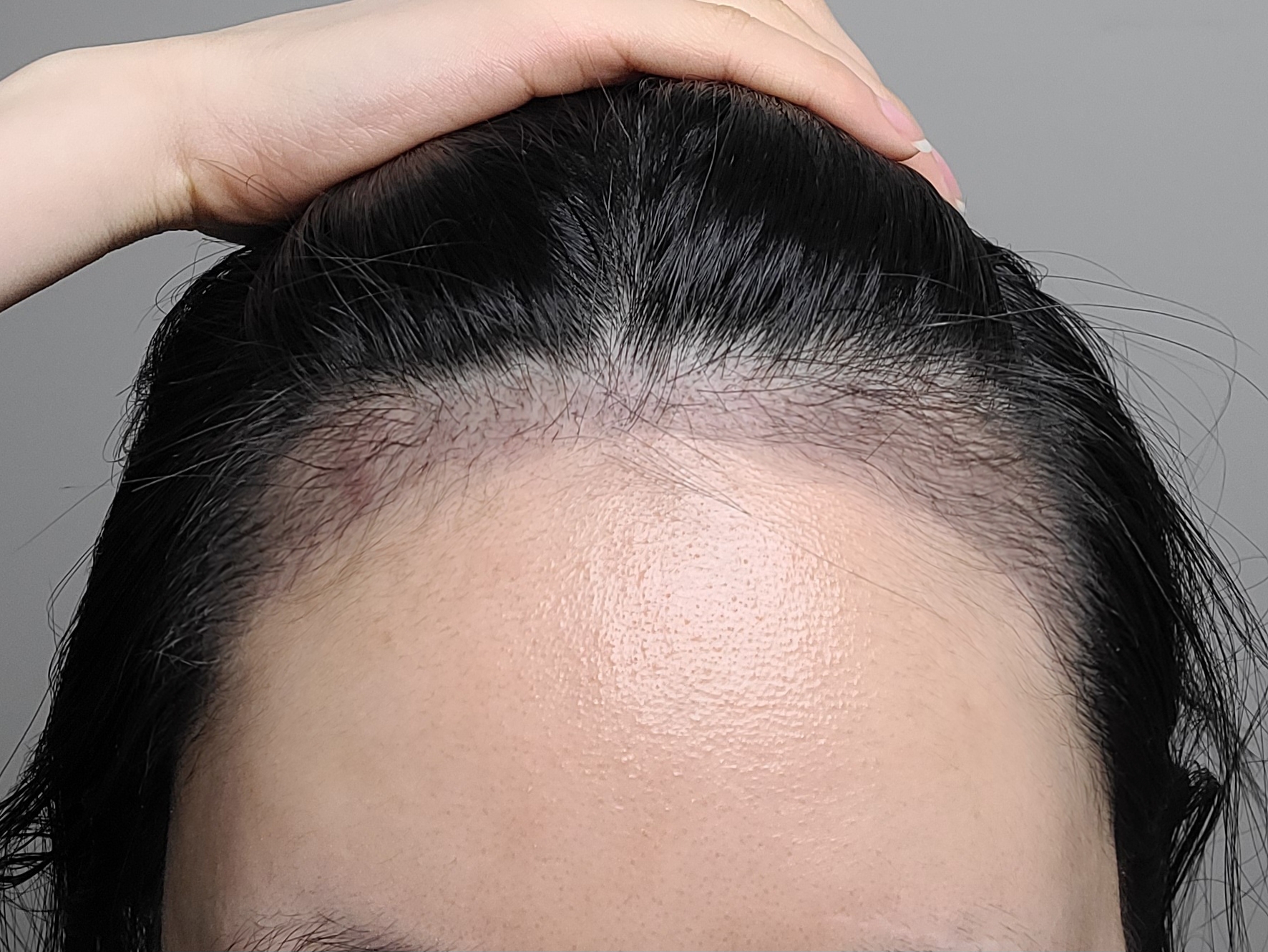 수술후기이미지