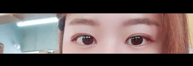 수술후기이미지