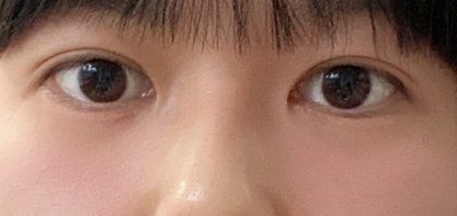 수술후기이미지