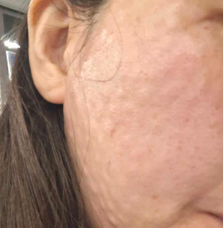 수술후기이미지