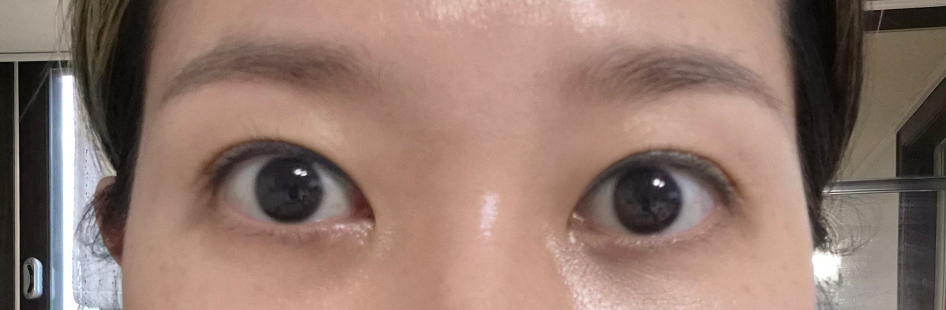 수술후기이미지