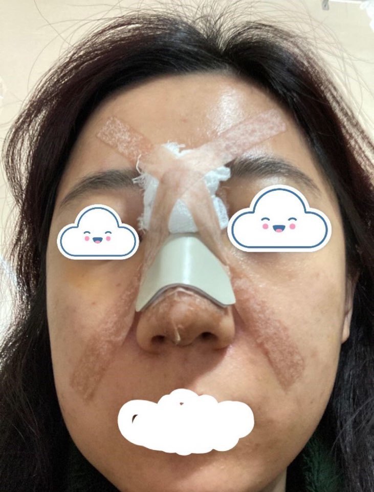 수술후기이미지