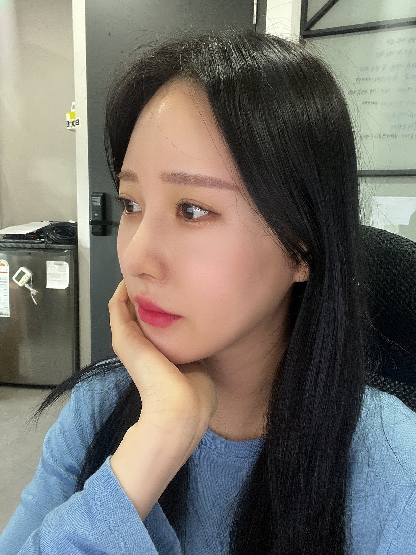 수술후기이미지