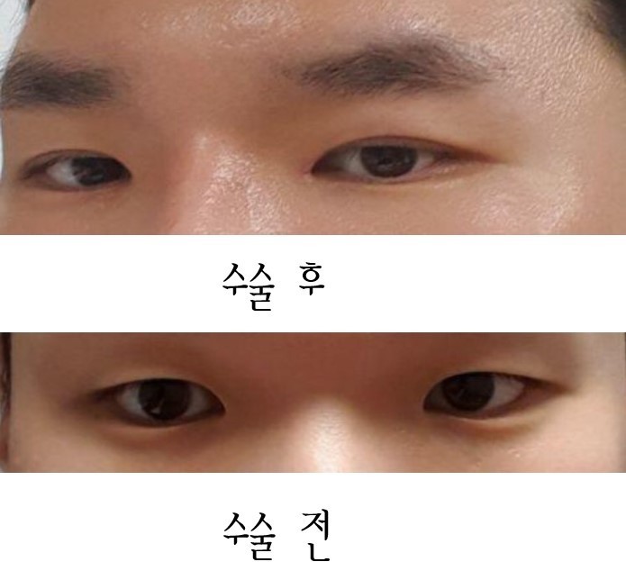 수술후기이미지