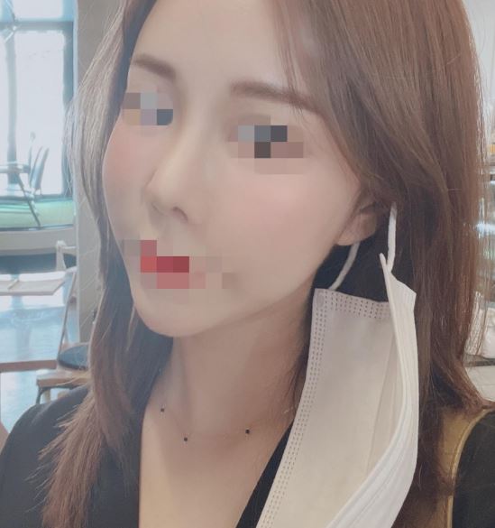 수술후기이미지