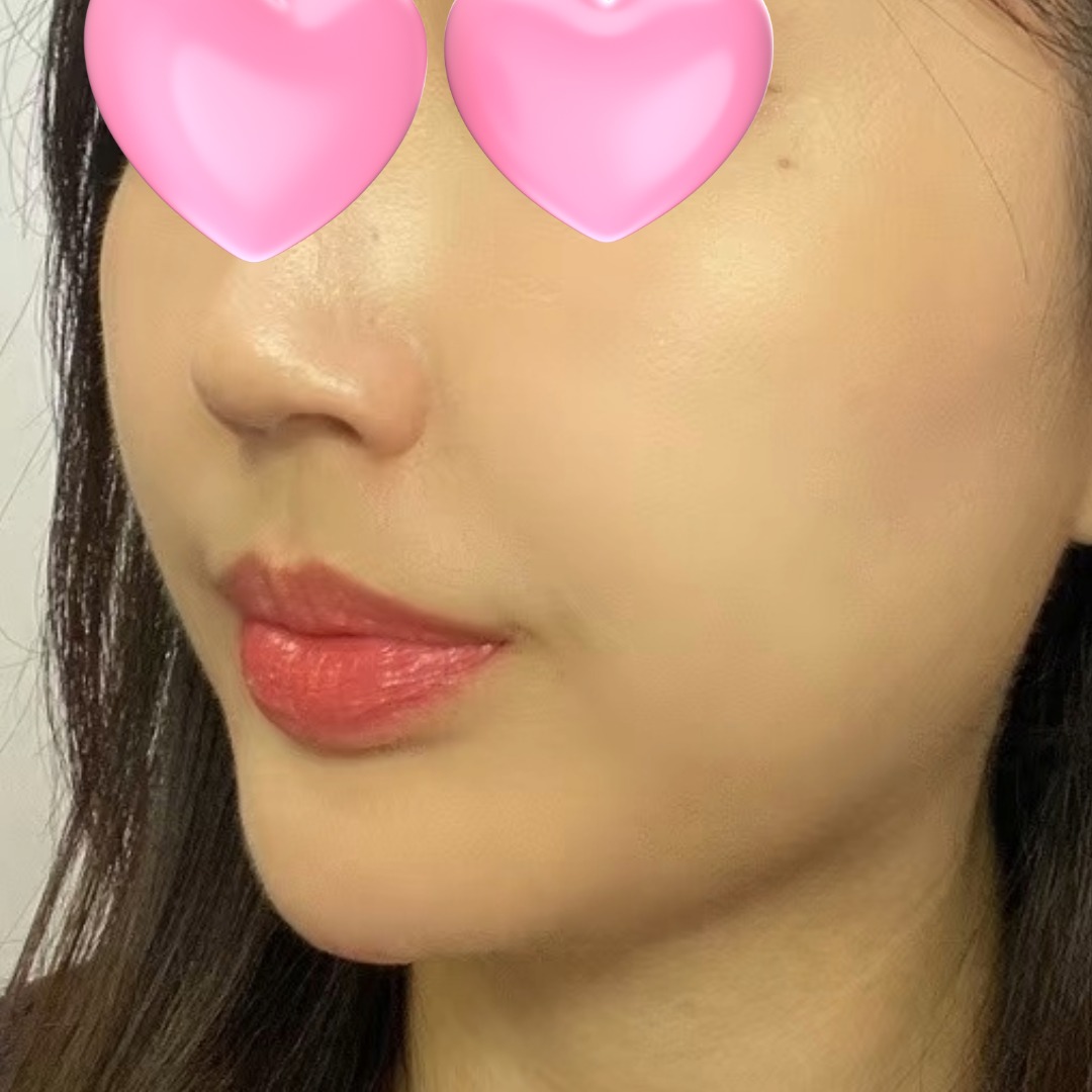 수술후기이미지