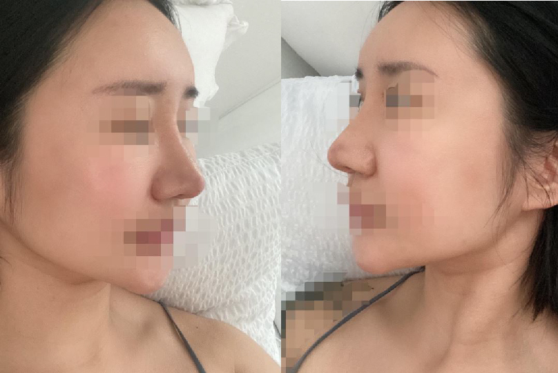 수술후기이미지