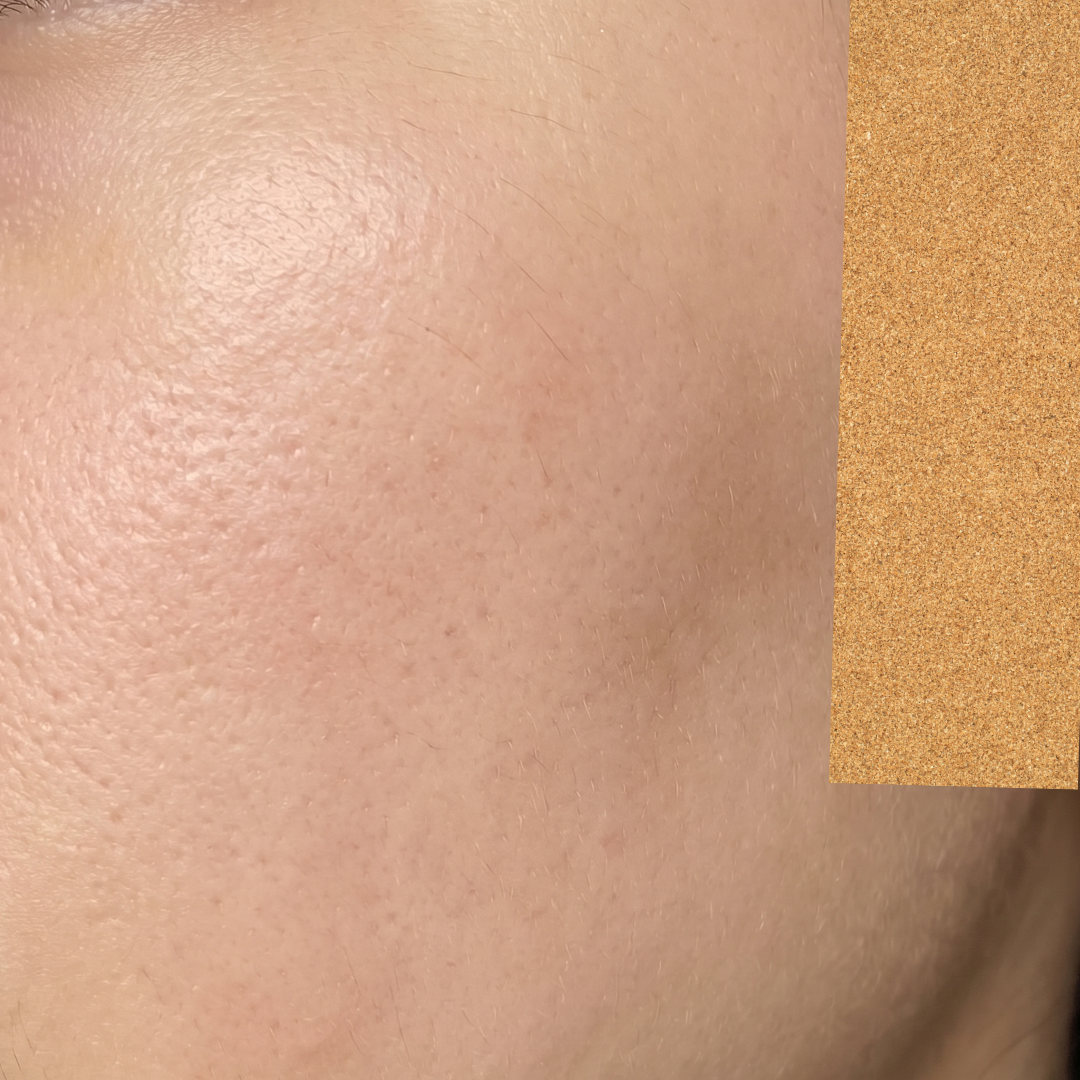 수술후기이미지