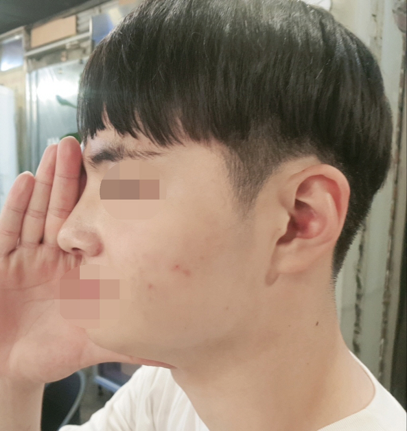 수술후기이미지